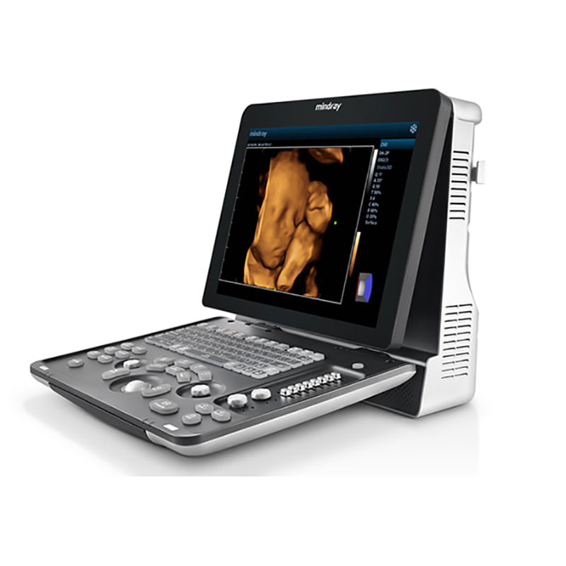 Ultrasonido Portátil B/N Z50 Mindray