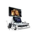 Ultrasonido de Gabinete DC40-HD 
