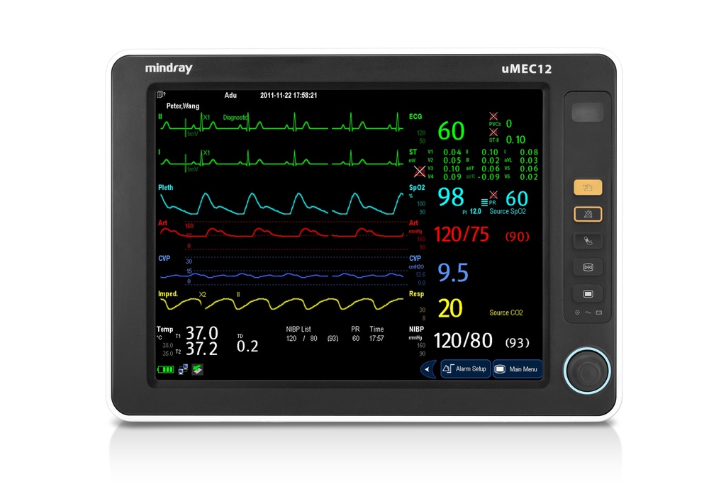 Monitor de Signos Vitales de 7 Parámetros uMEC 12 