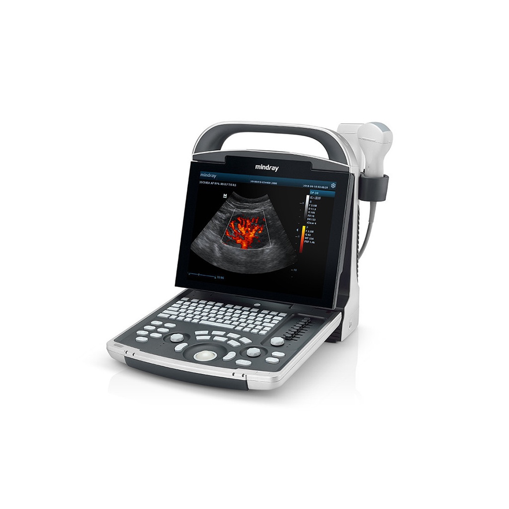 [UPM-UL054-M] Ultrasonido Portátil B/N DP-30 